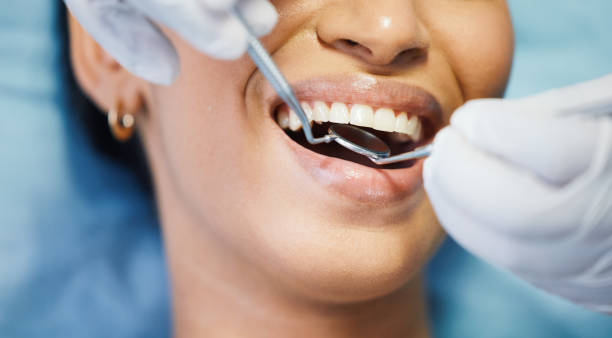 Best Emergency Root Canal Treatment in Darlington, WI