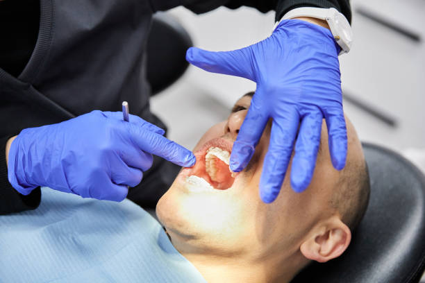 Best Emergency Tooth Extraction in Darlington, WI